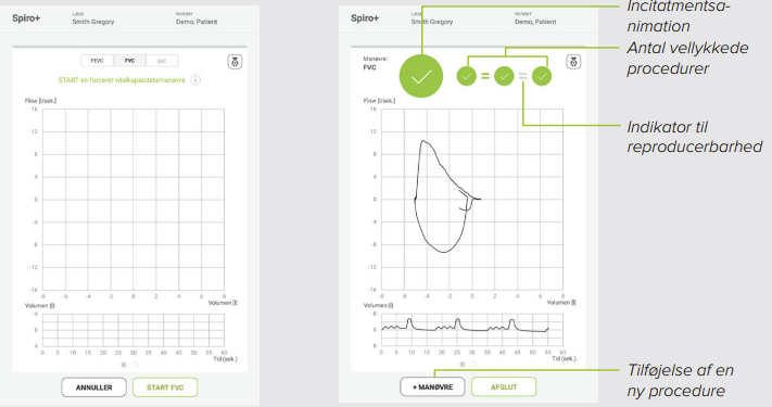MESI mTABLET SPIRO - SPIRO+ FVC Maneuver