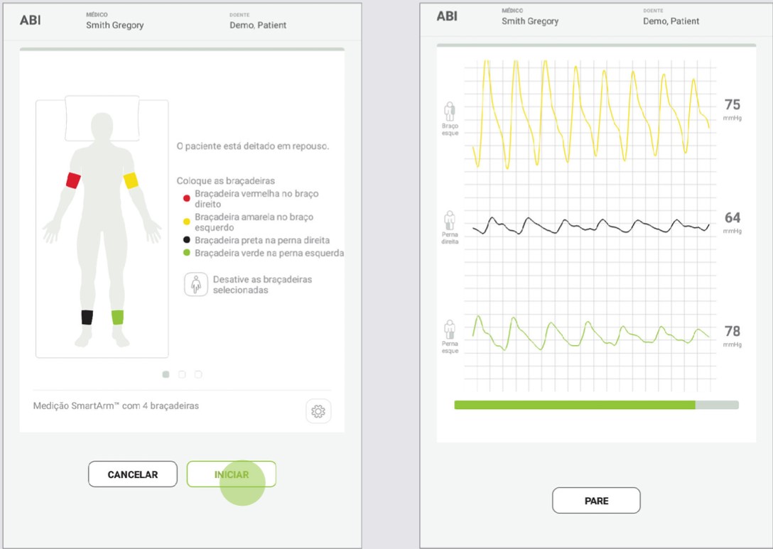 PT - MESI mTABLET ABI - REALIZAR MEDIÇÃO ABI - Step 4