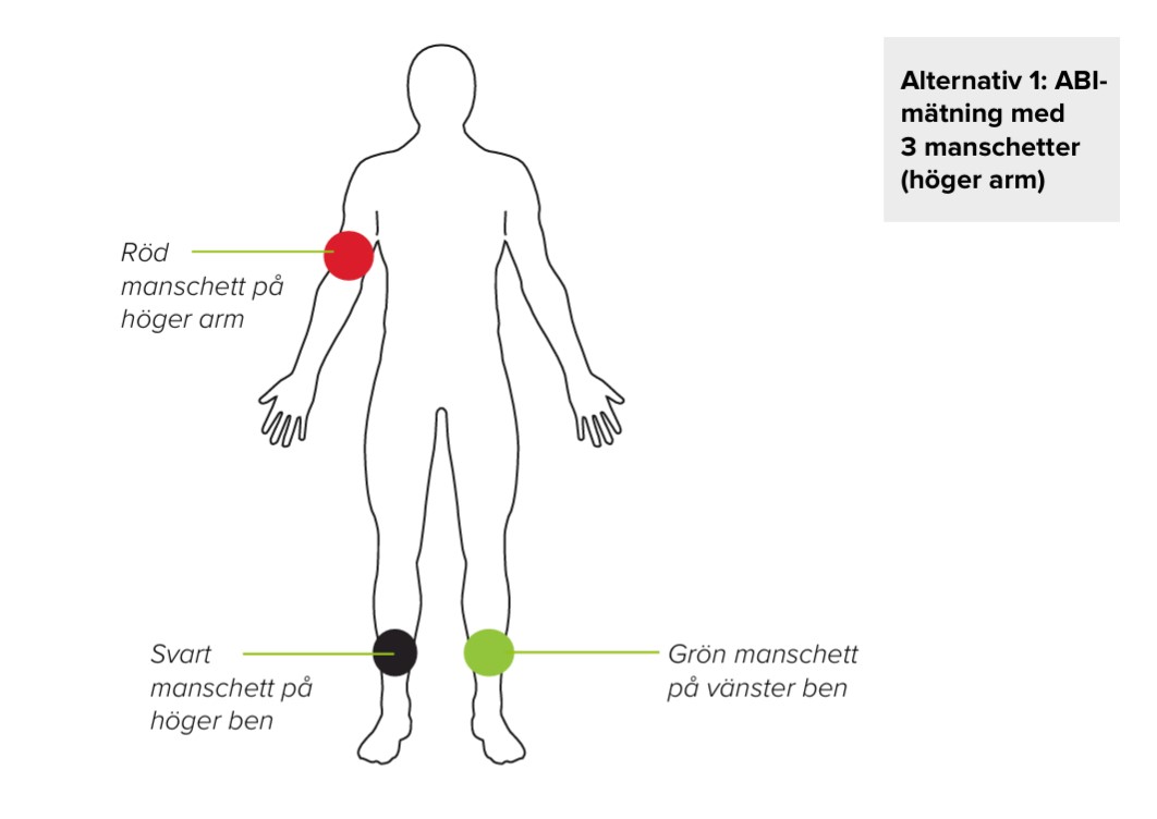 SV - MESI mTABLET ABI - MANSCHETTPLACERING 02