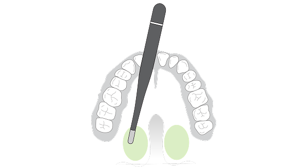 oral