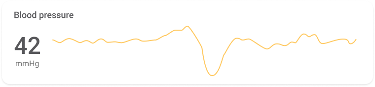 bp-measurement-graph