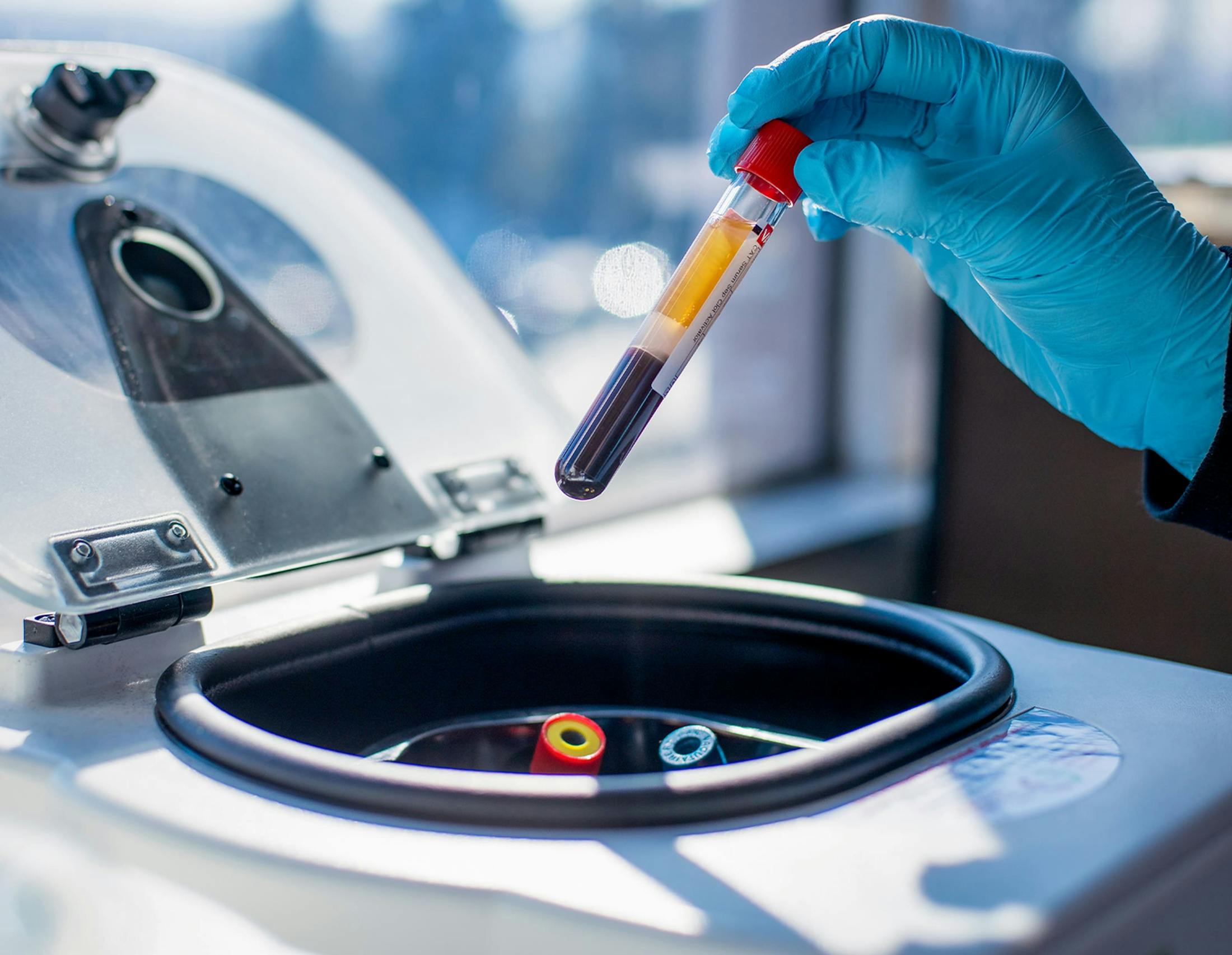 a blue gloved hand pulling a vile of blood from a centrifuge