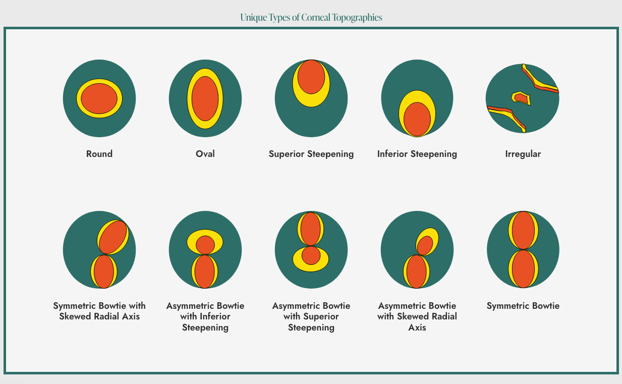 unique types of Corneal Topographies