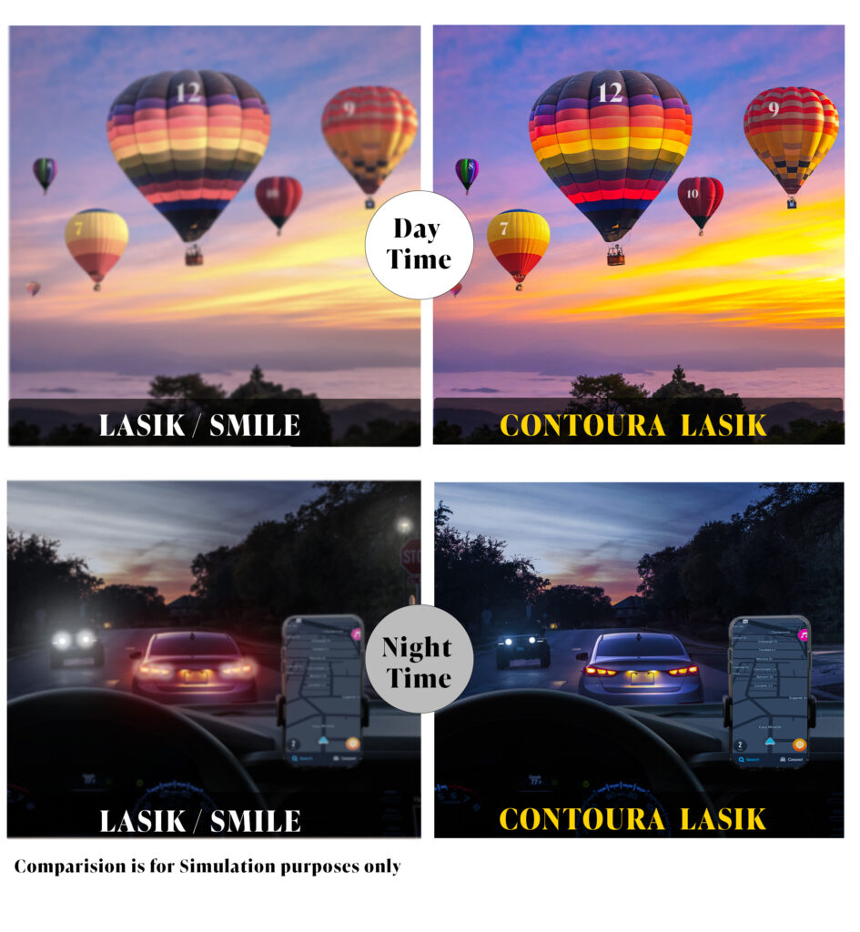 Comparing Traditional LASIK, and Contoura® LASIK