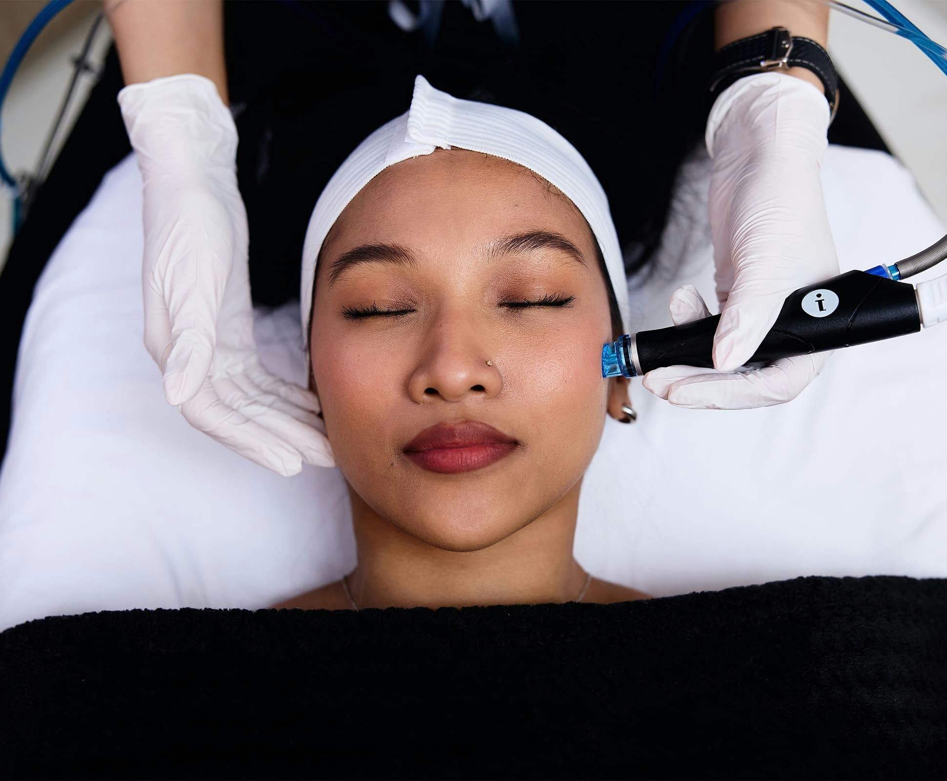 bird's eye view of woman getting microneedling procedure done