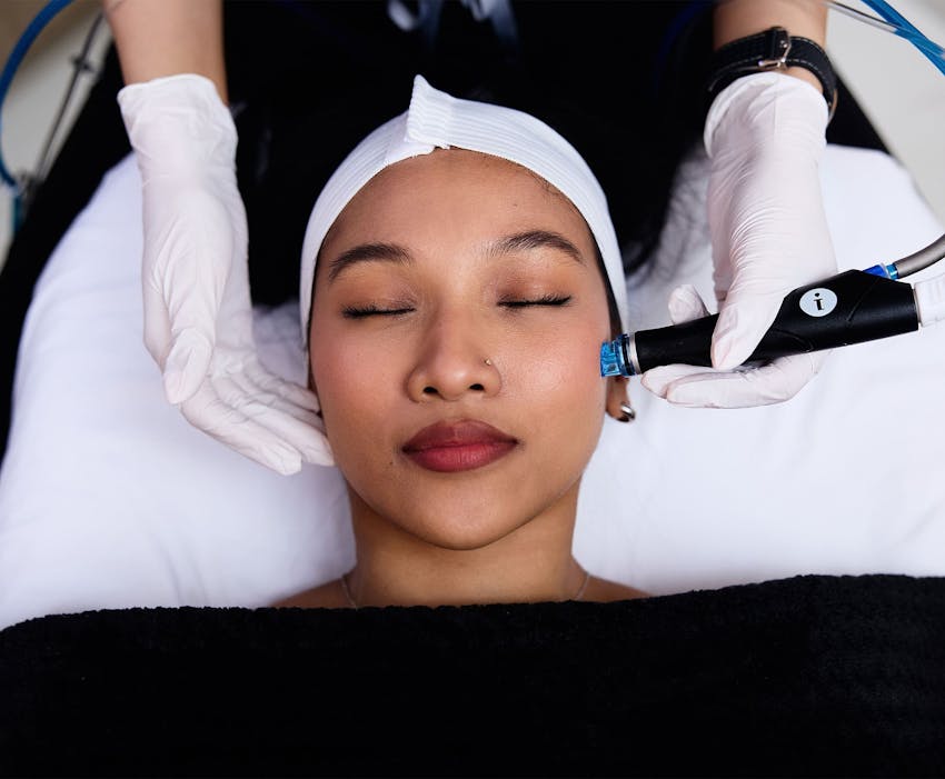 bird's eye view of woman getting microneedling procedure done