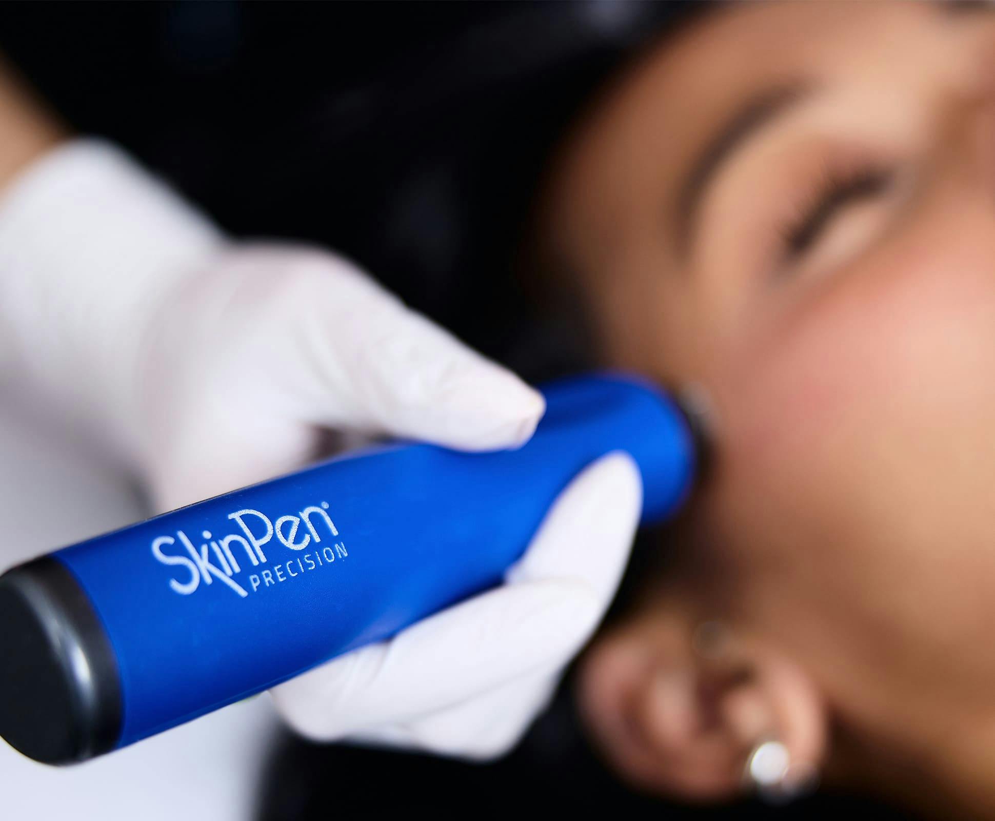 close up on skin pen precision being used on patient's face