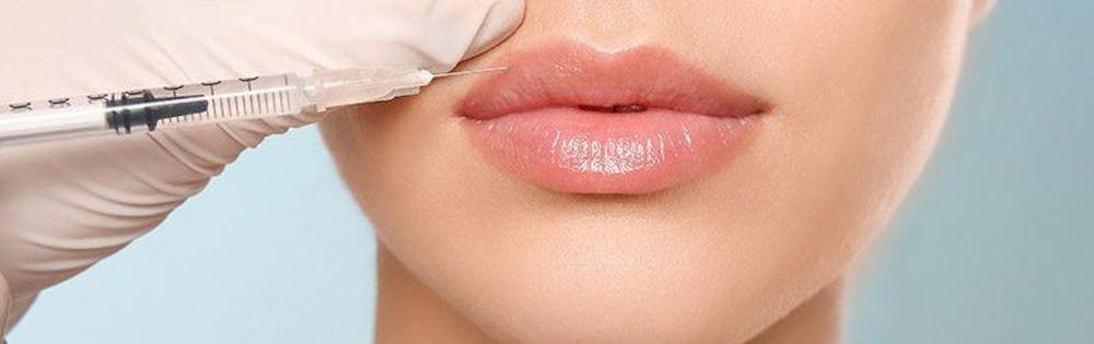 woman getting lip fillers