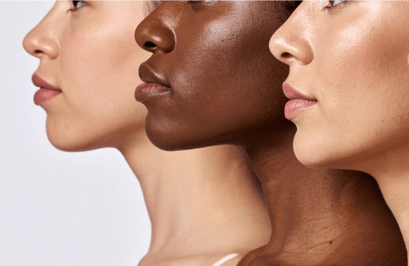 image of the lower face of three women