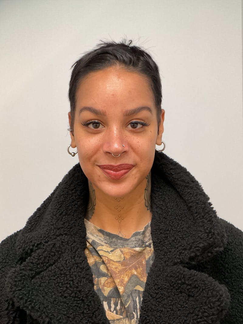 Hydrafacial Before & After Gallery - Patient 180241 - Image 2