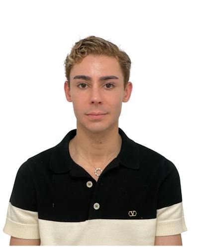 Facial Balancing Before & After Gallery - Patient 820526 - Image 2