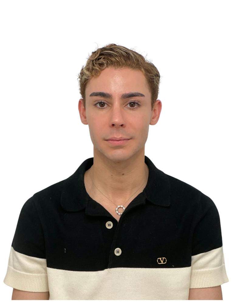 Facial Balancing Before & After Gallery - Patient 820526 - Image 2