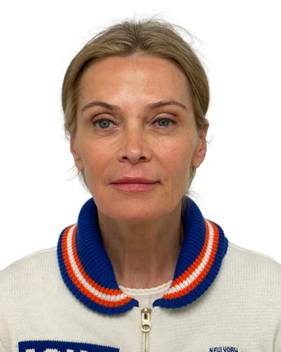 Facial Balancing Before & After Gallery - Patient 283250 - Image 2