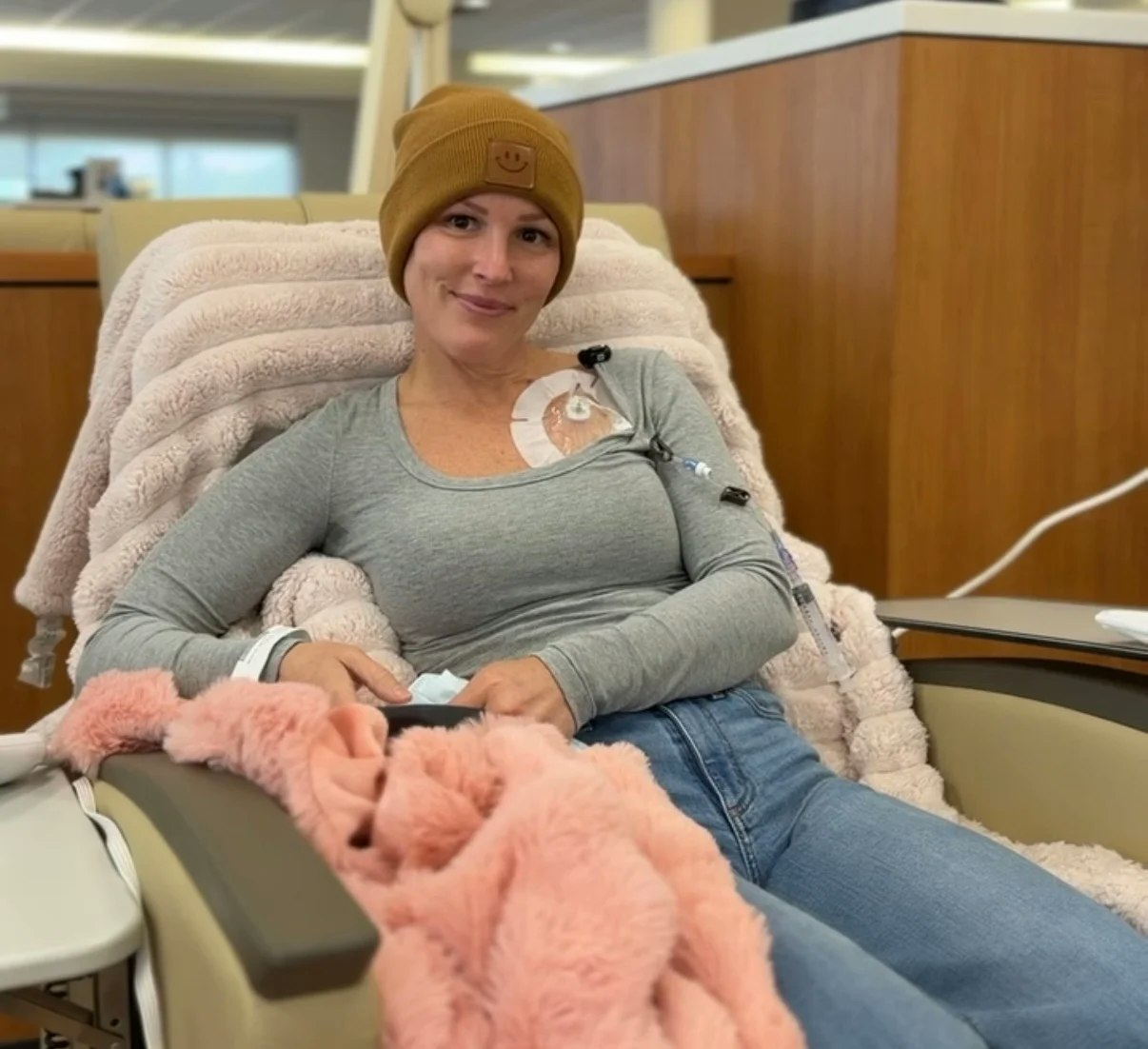 Jess during Chemotherapy Jess during Chemotherapy