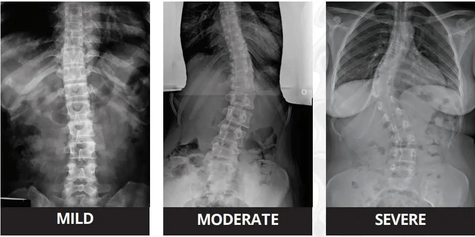 xray