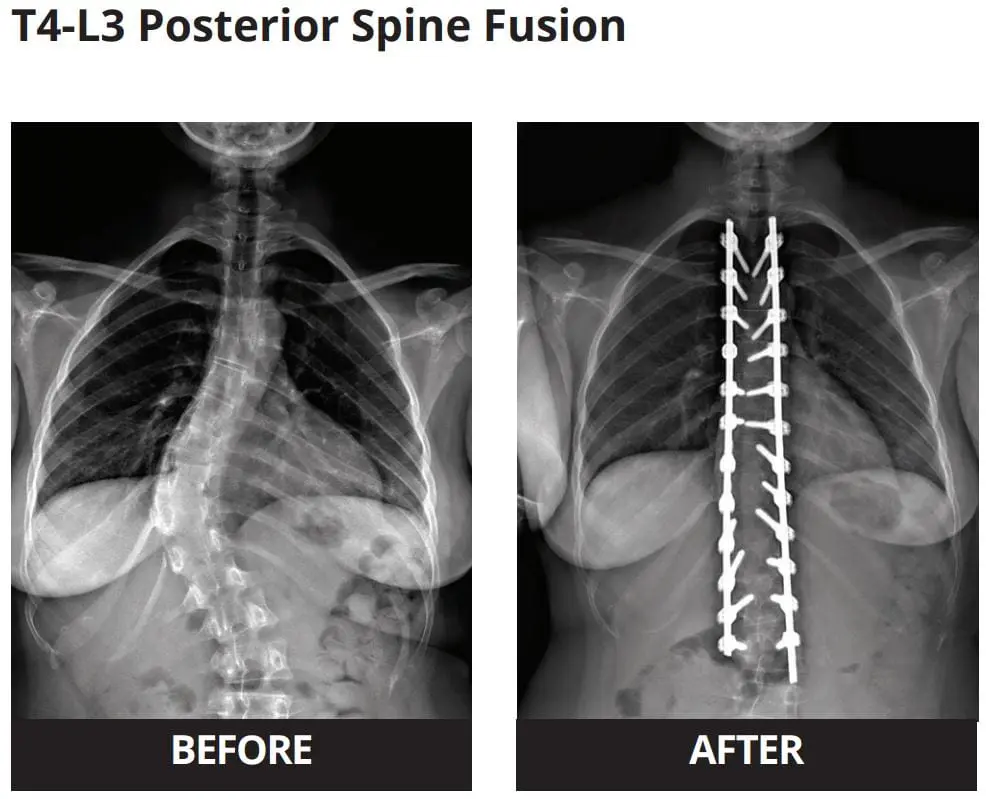 xray