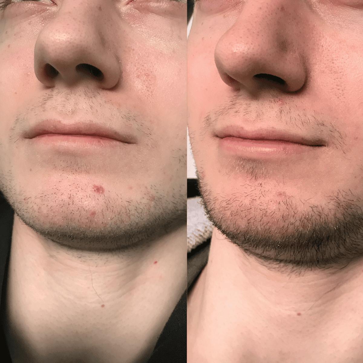 1540 Before & After Gallery - Patient 417883 - Image 1
