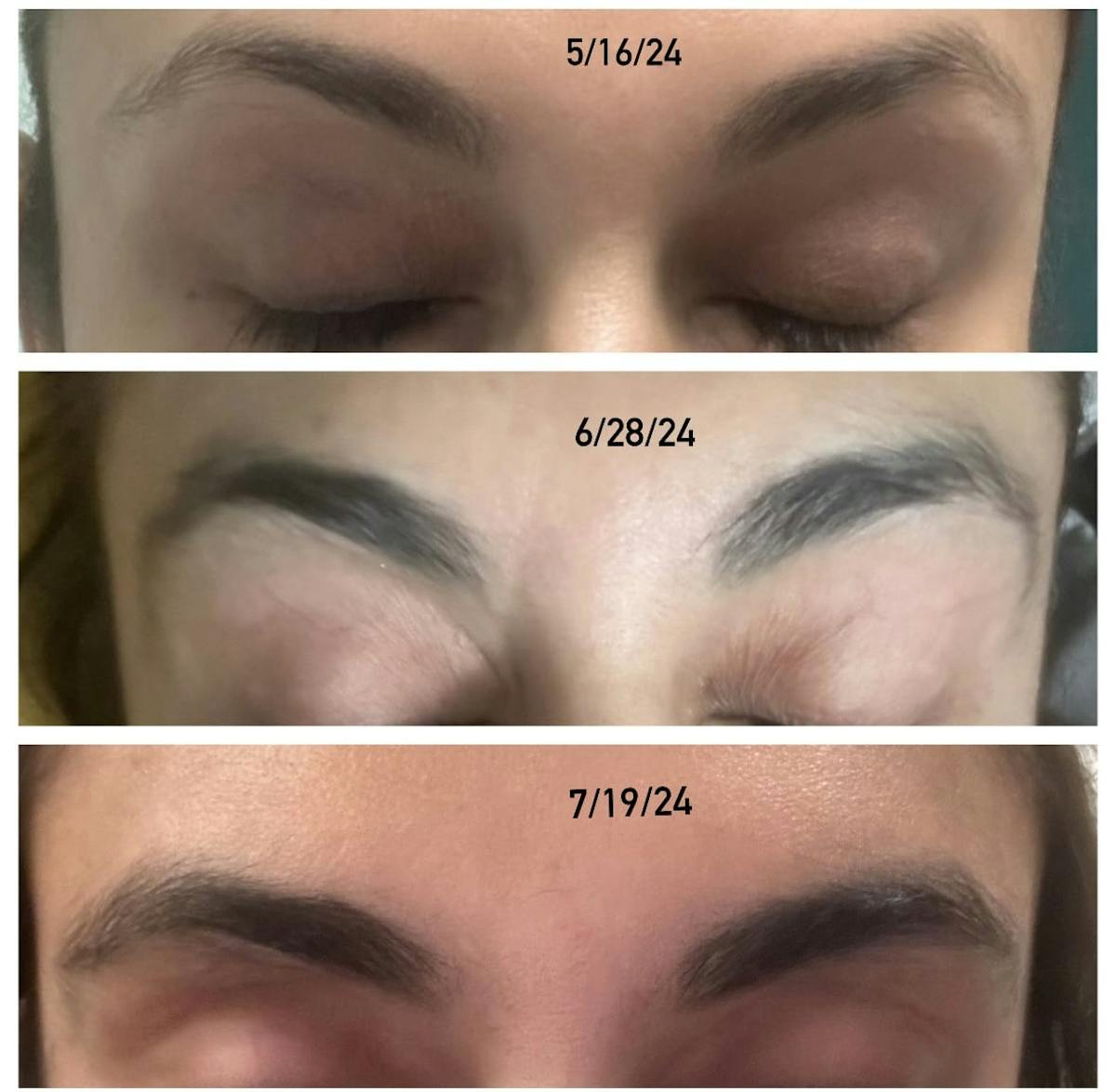 Obagi Before & After Gallery - Patient 178144 - Image 1