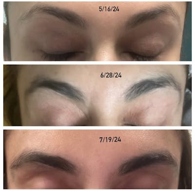 Obagi Before & After Gallery - Patient 178144 - Image 1