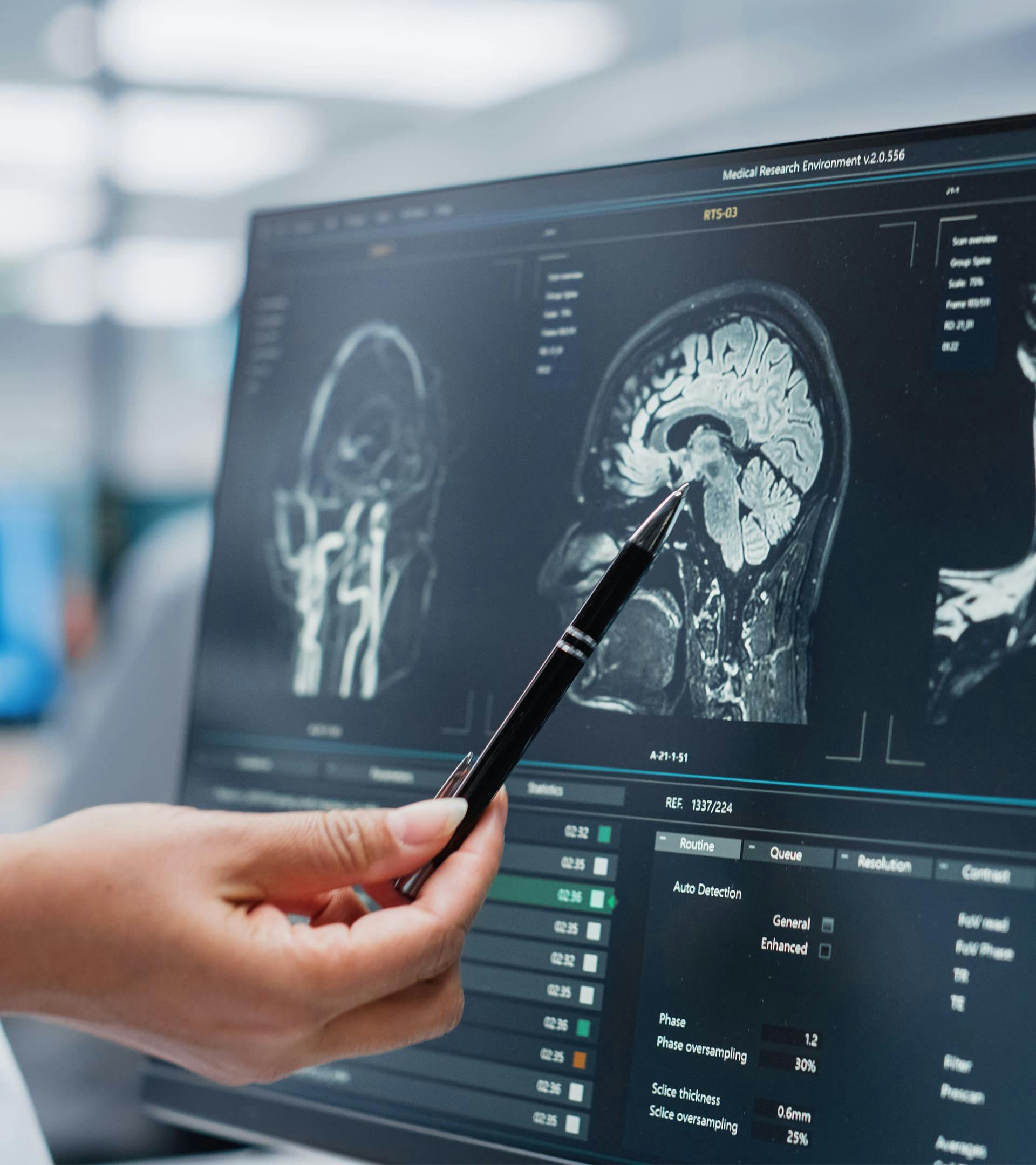 A medical computer showing a brain