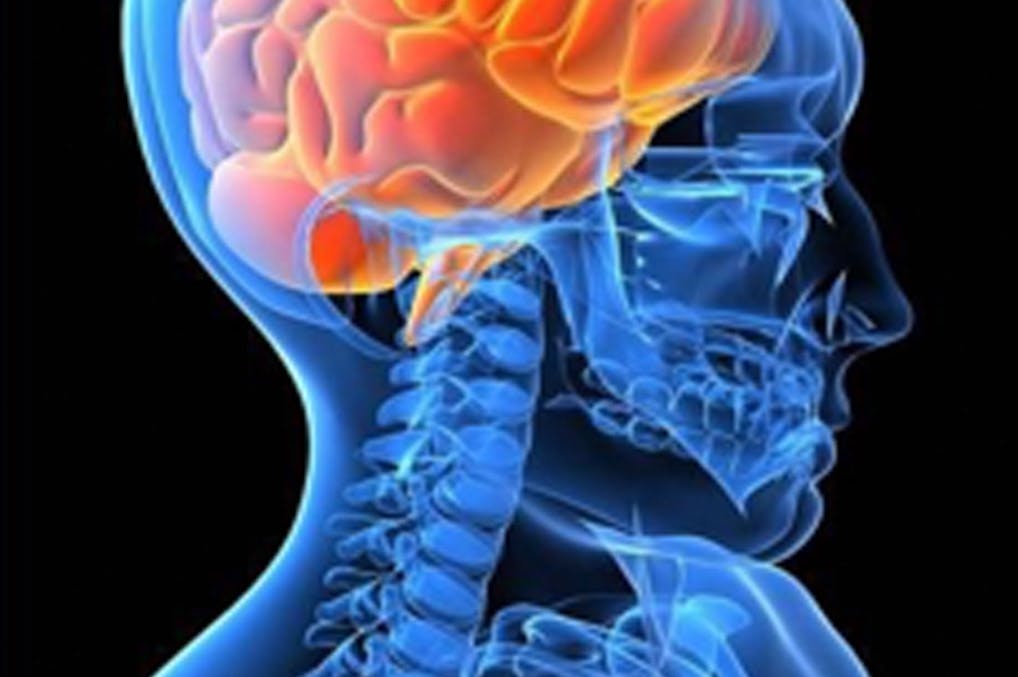 Head injuries are a common occurrence in automobile collisions
