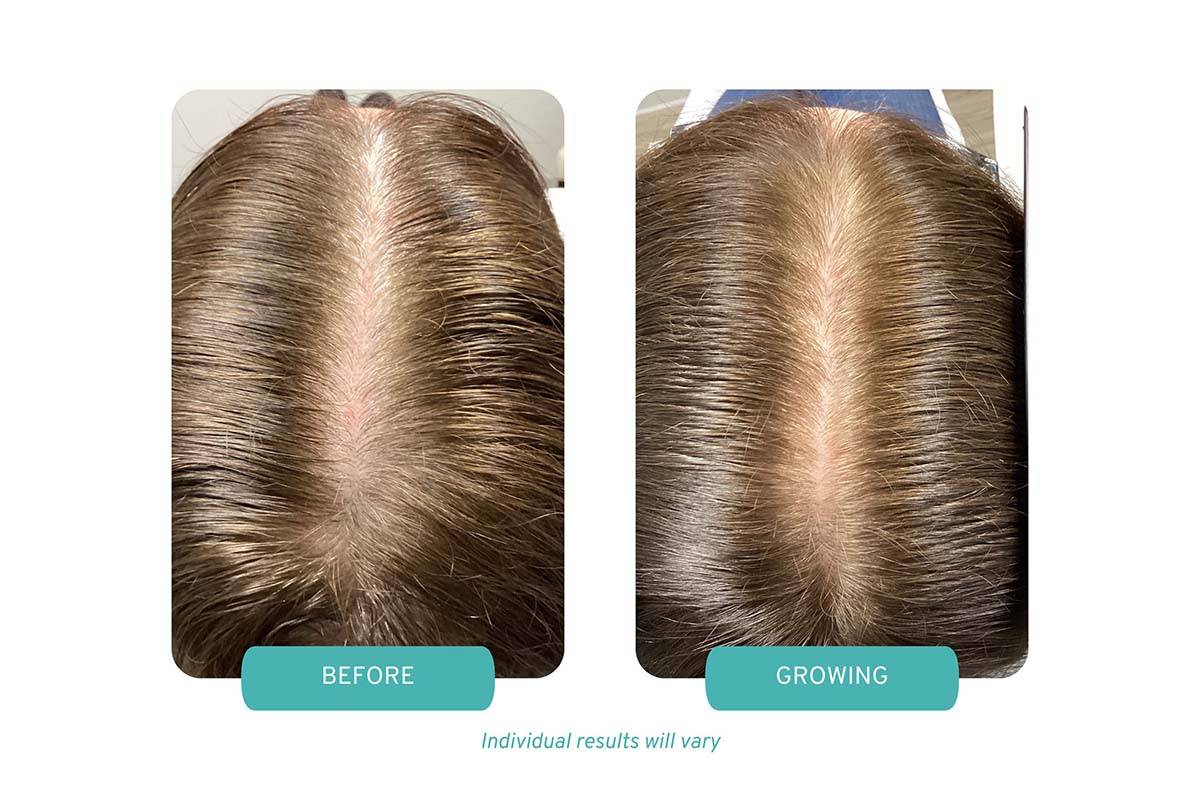 patient results