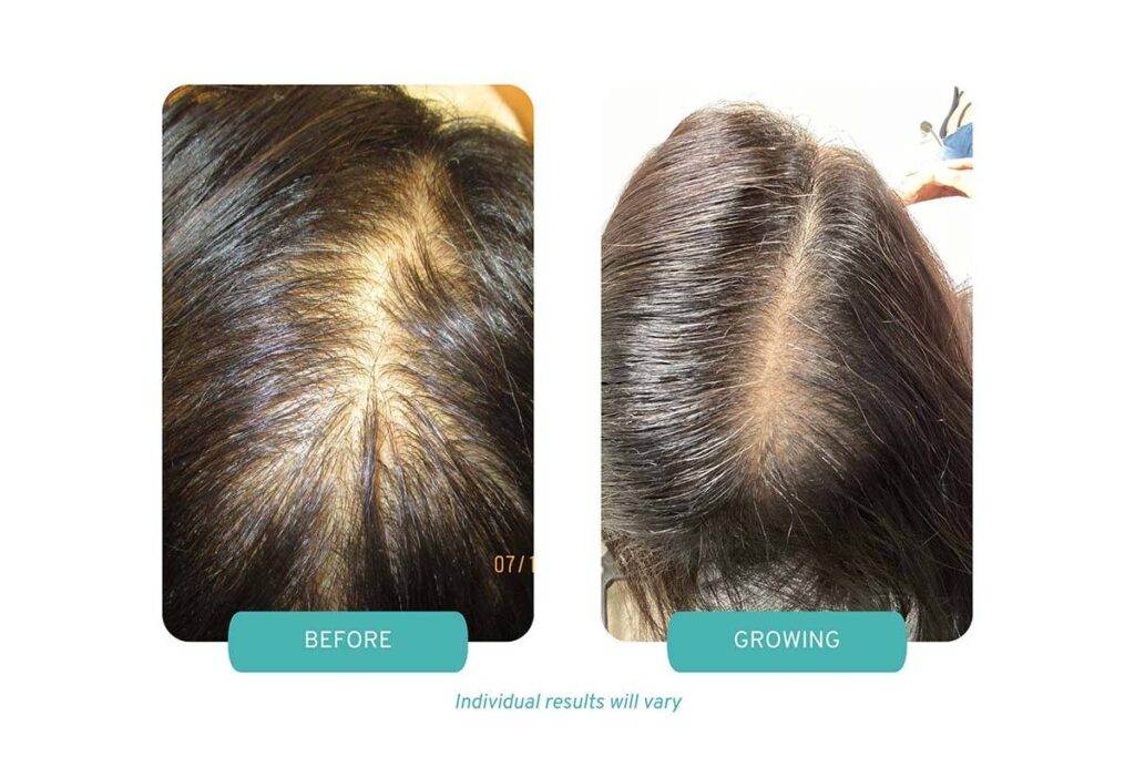 patient results
