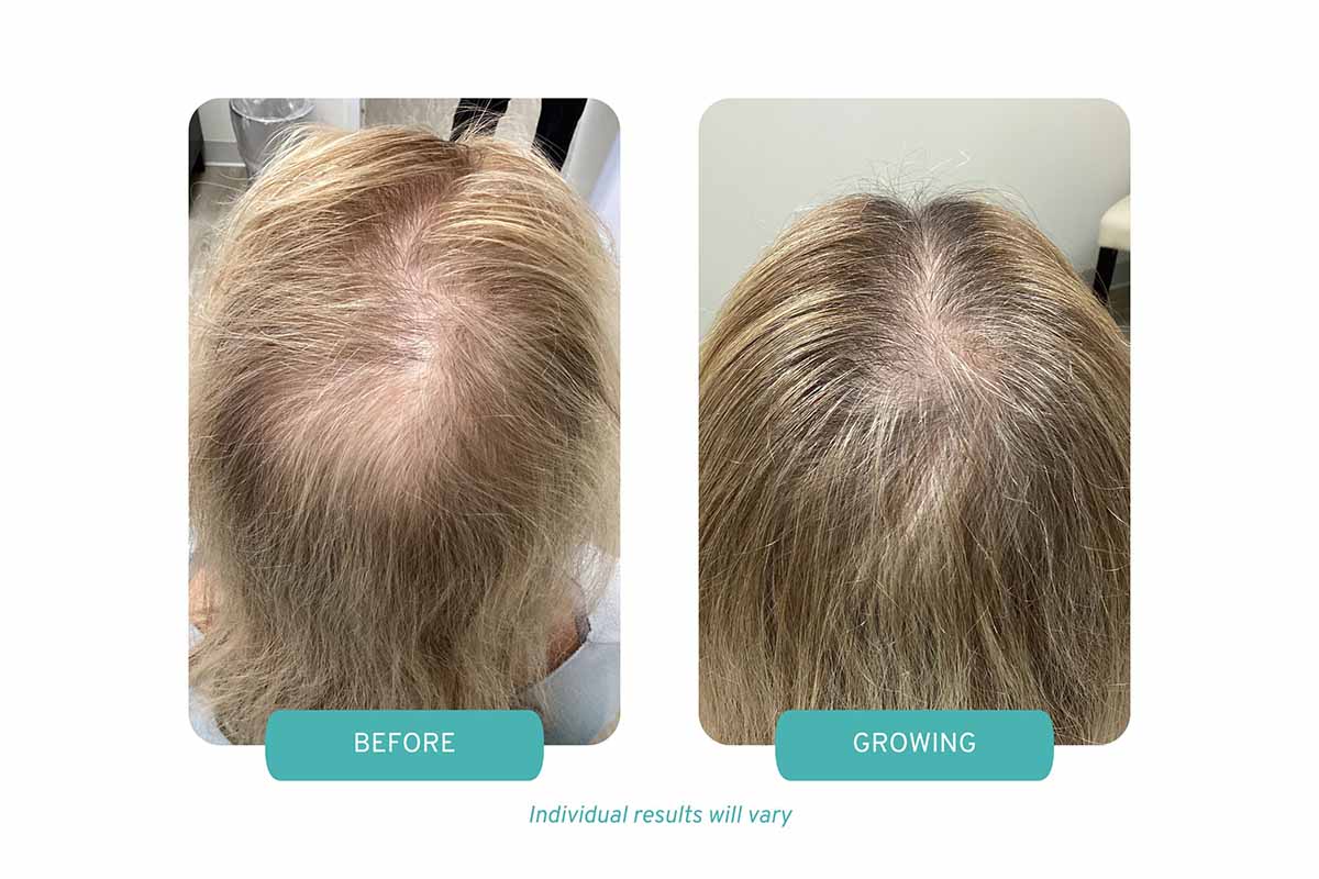 patient results