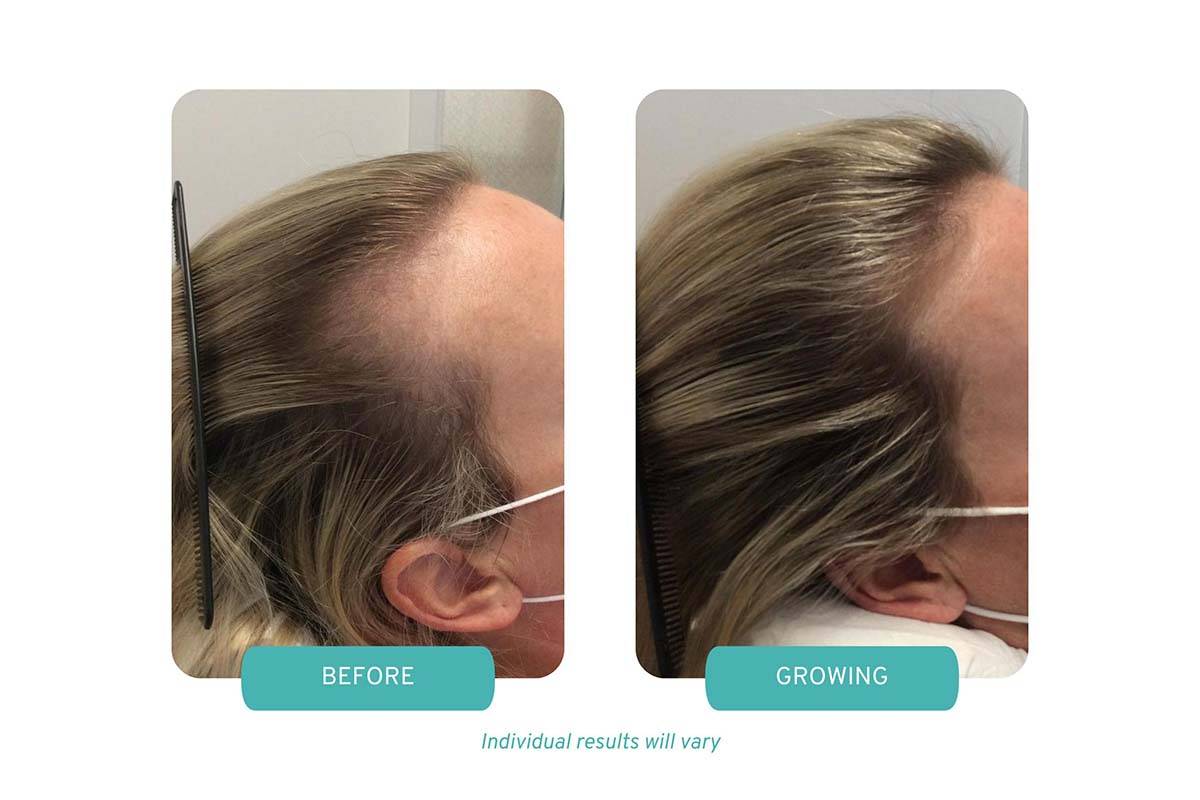 patient results