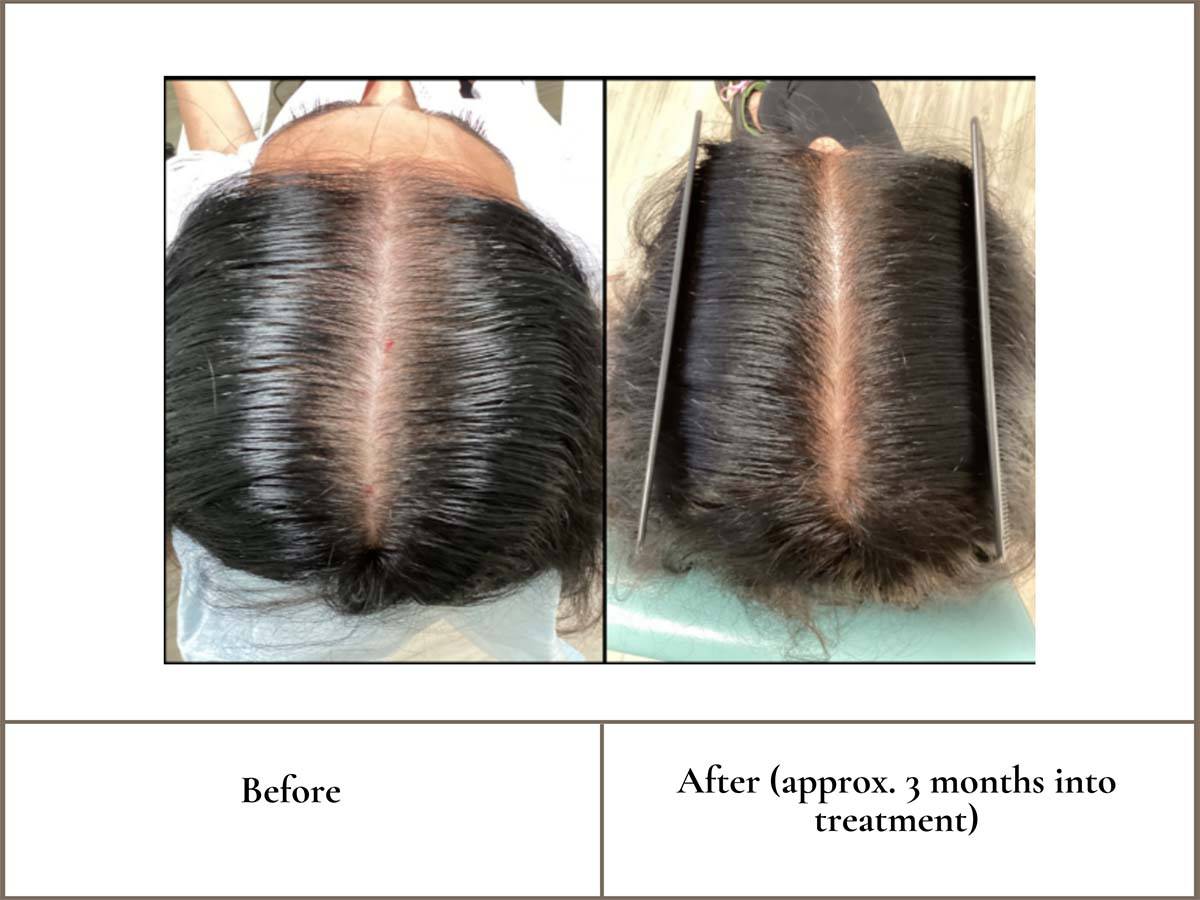 patient results
