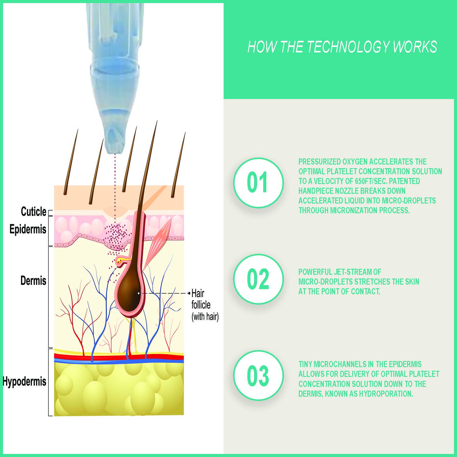 The Latest Advancement in Platelet Rich Plasma: Painless Injections