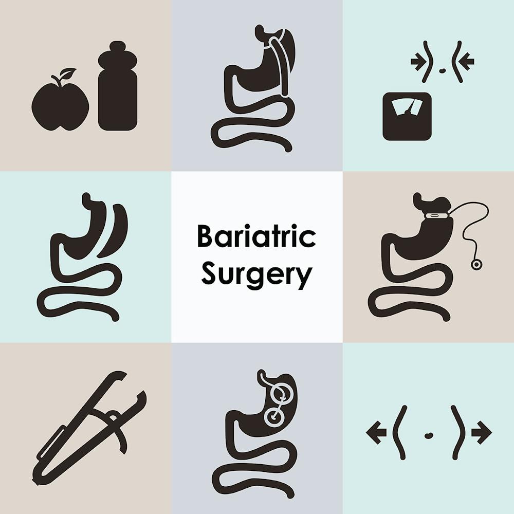 bariatric surgery infographic