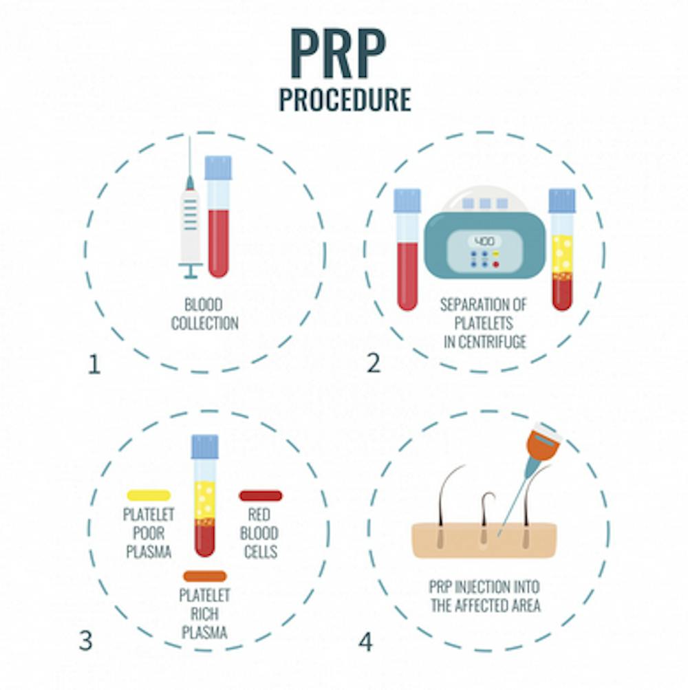 prp infographic