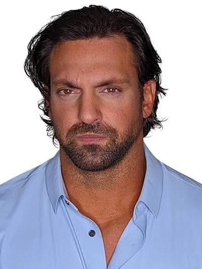 Male Hair Transplants Before & After Gallery - Patient 121391 - Image 2