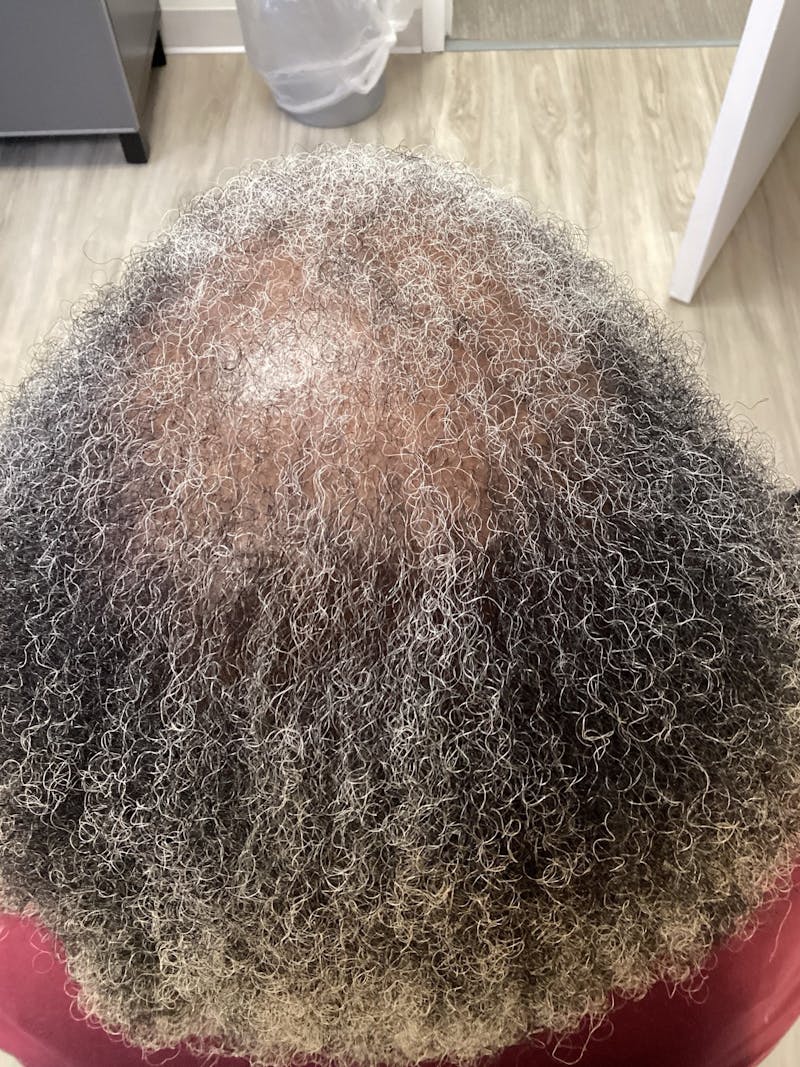 Medications Before & After Gallery - Patient 635582 - Image 1