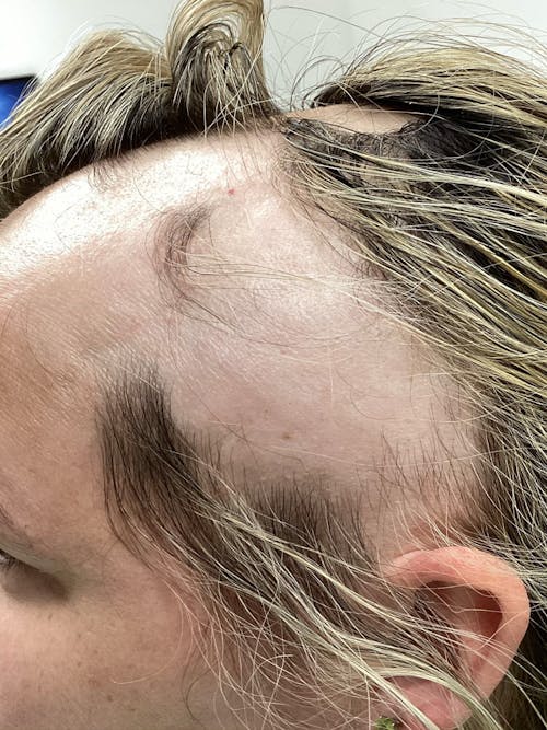 patient hair before