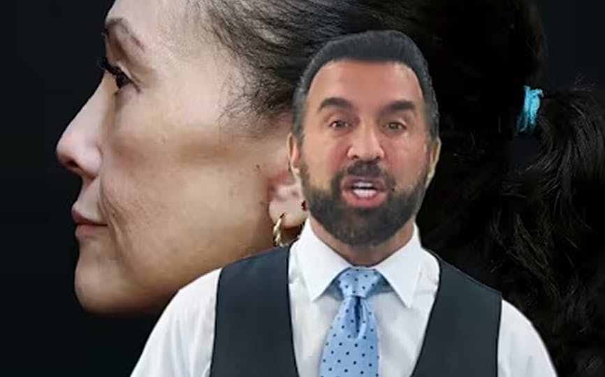 Before-and-after side profile of facelift patient