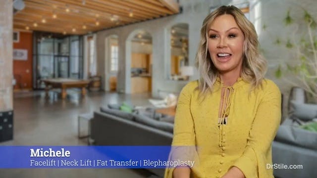 woman who got facial plastic surgery with Dr. Stile