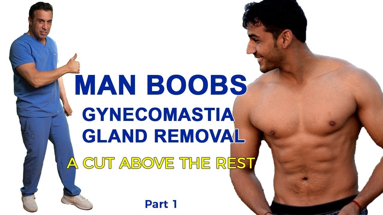 gynecomastia video screenshot