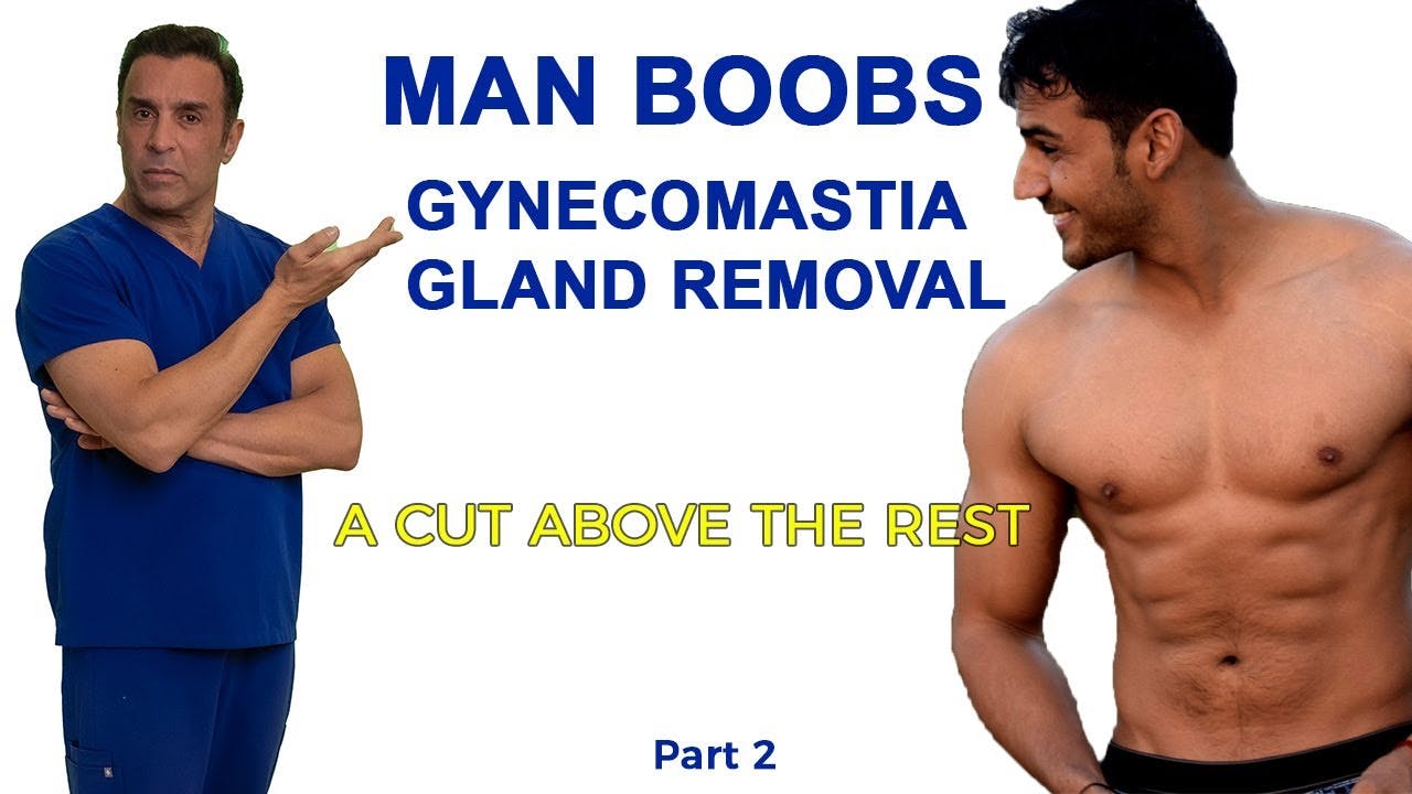gynecomastia video screenshot