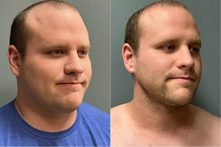 Top Cosmetic Surgery Chattanooga, Ooltewah TN & Calhoun, GA | Southern - Southern Surgical Arts In Chattanooga Tn