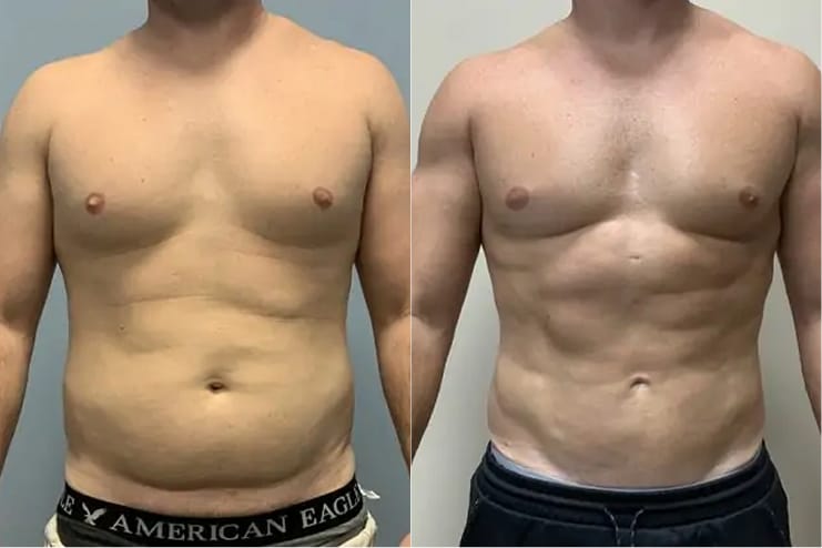 Top Cosmetic Surgery Chattanooga, Ooltewah TN & Calhoun, GA | Southern - Southern Surgical Arts In Chattanooga Tn