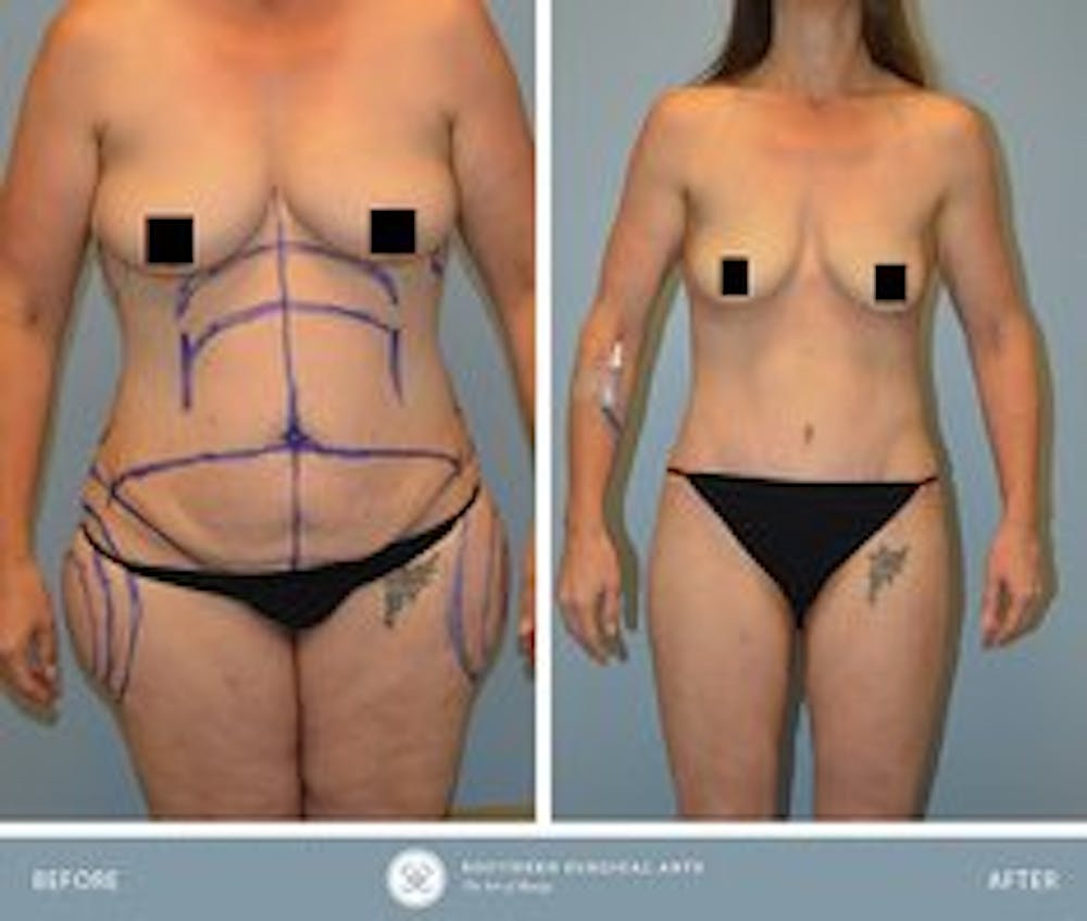 cosmetic surgery patient