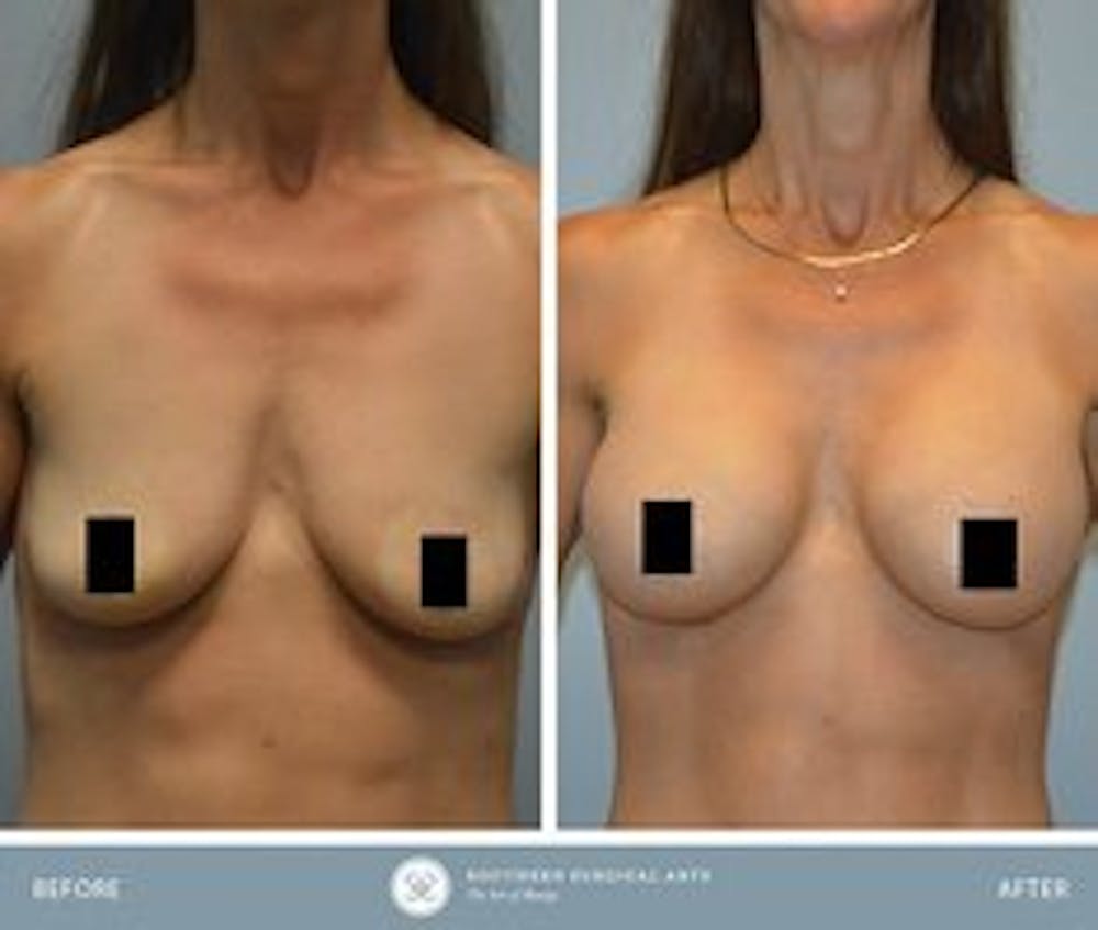 cosmetic surgery patient