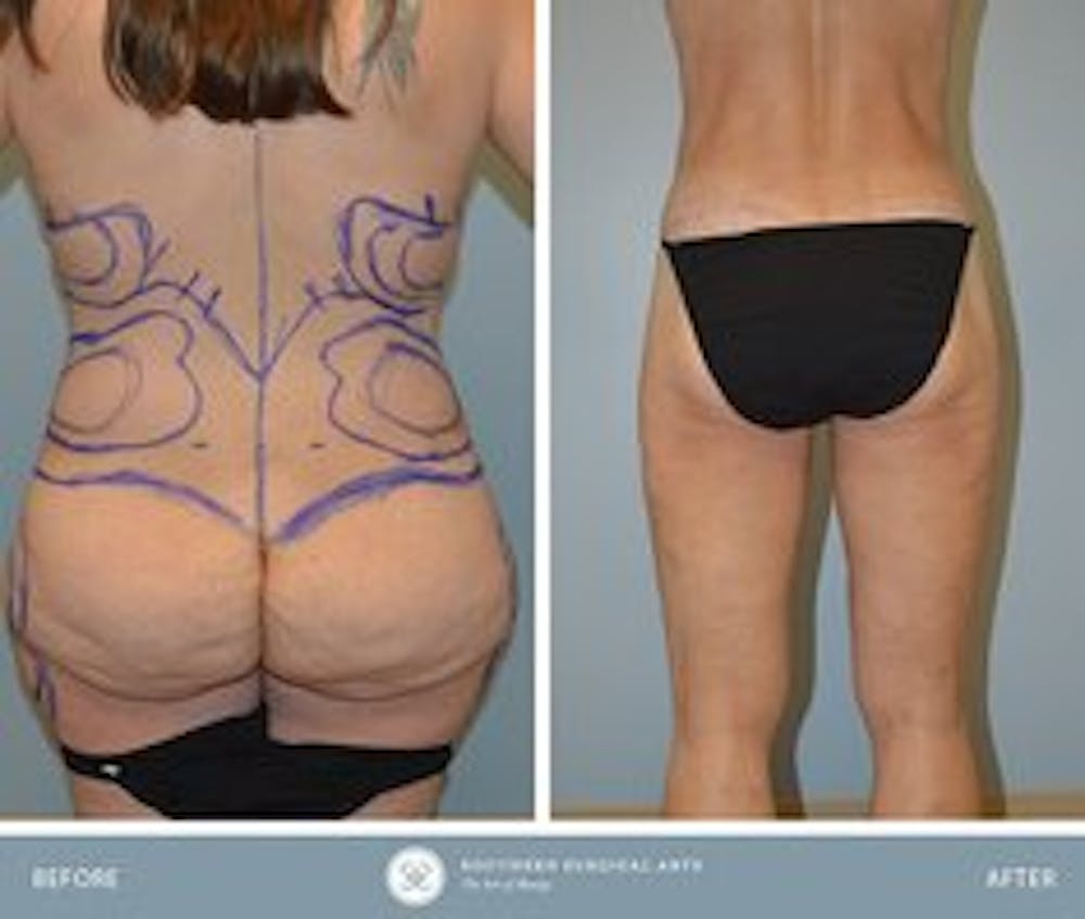 cosmetic surgery patient