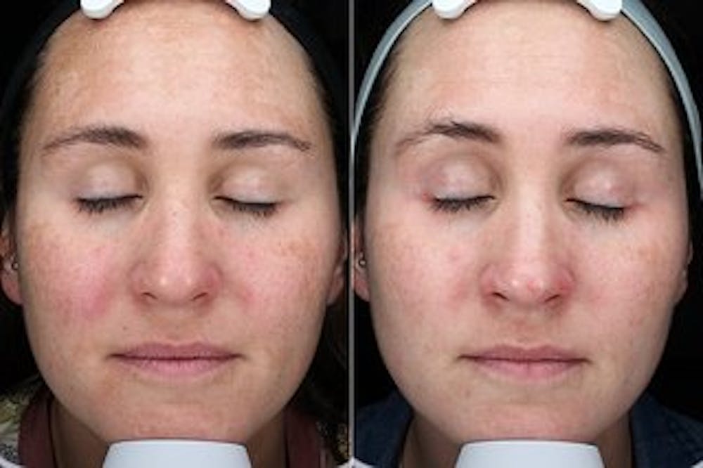 patient results