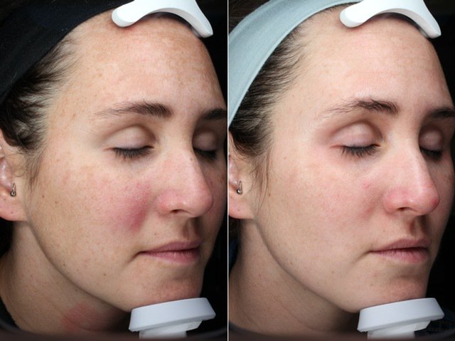 Get Your Glow Back with Halo | SSA