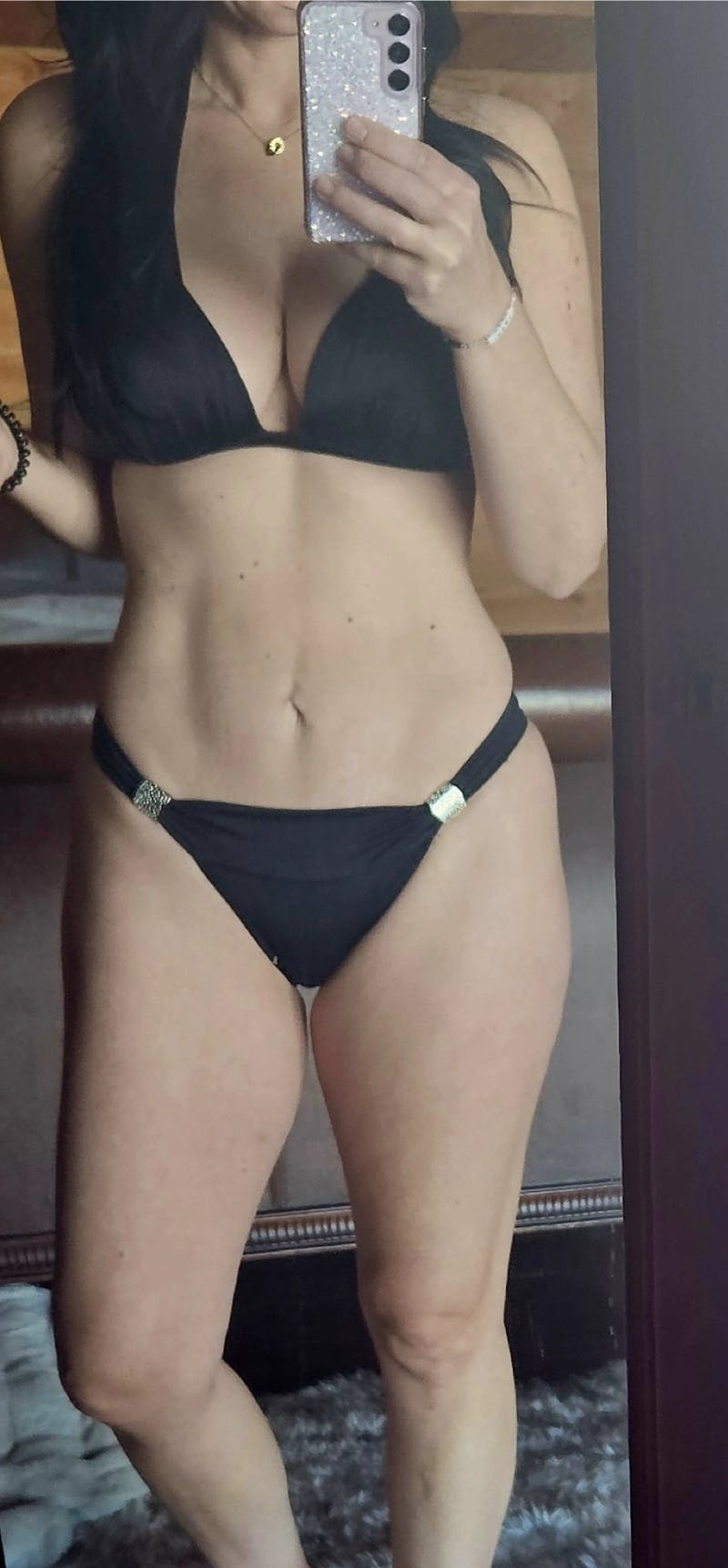 High Definition Mommy Makeover Before & After Gallery - Patient 111947 - Image 2