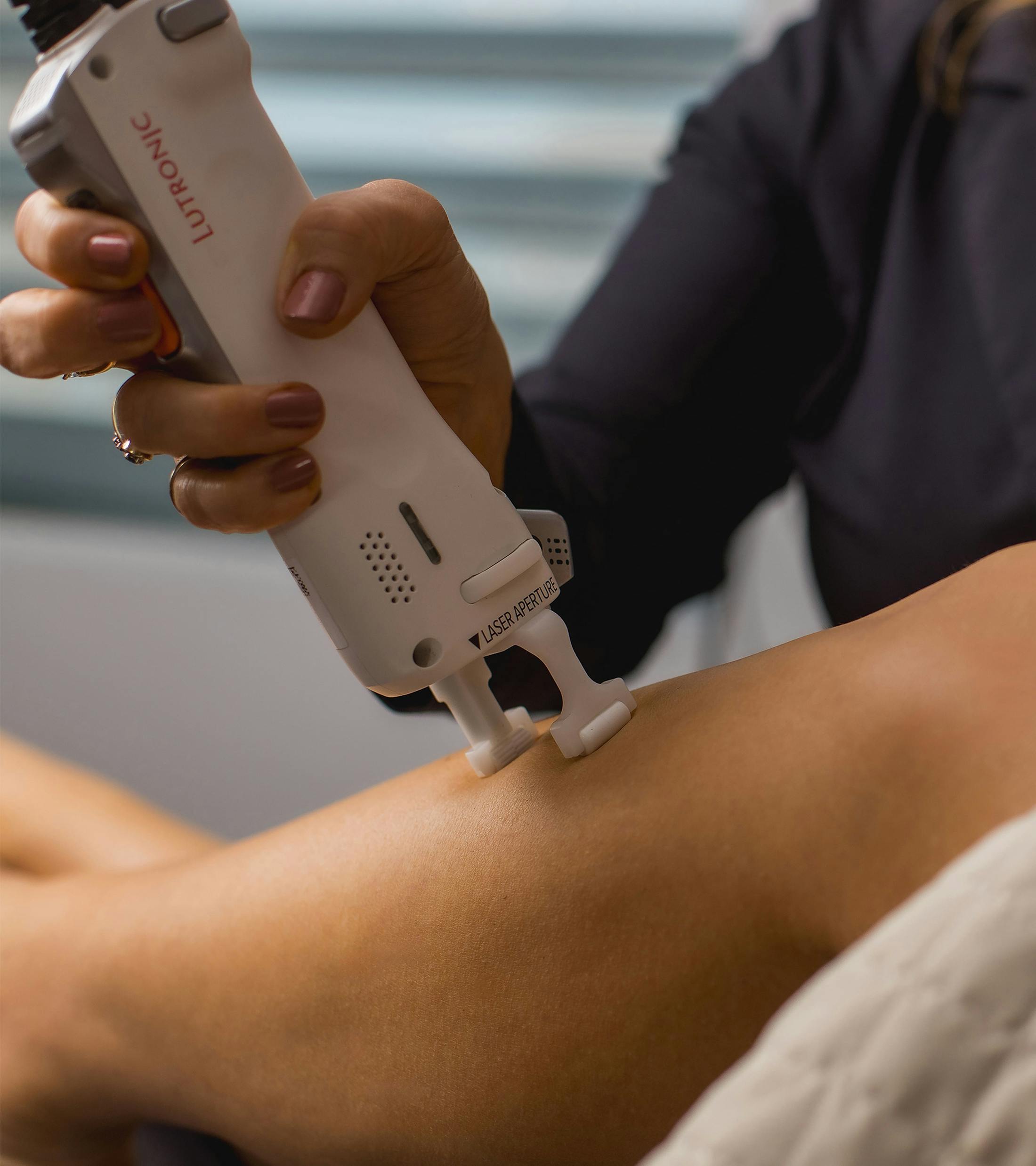 laser tattoo removal machine pressed to patients shin