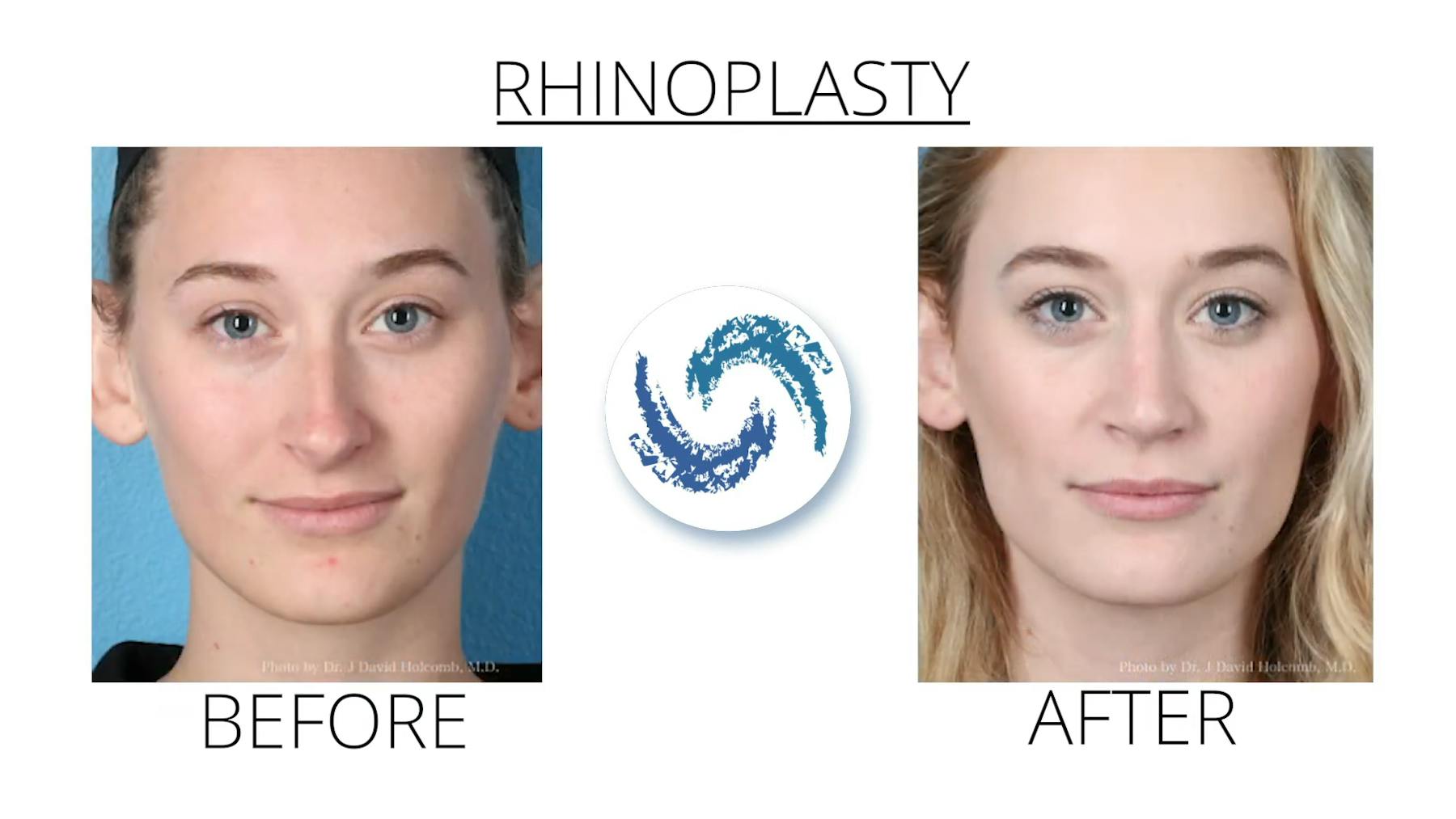 Holcomb - Kreithen Plastic Surgery & Medspa